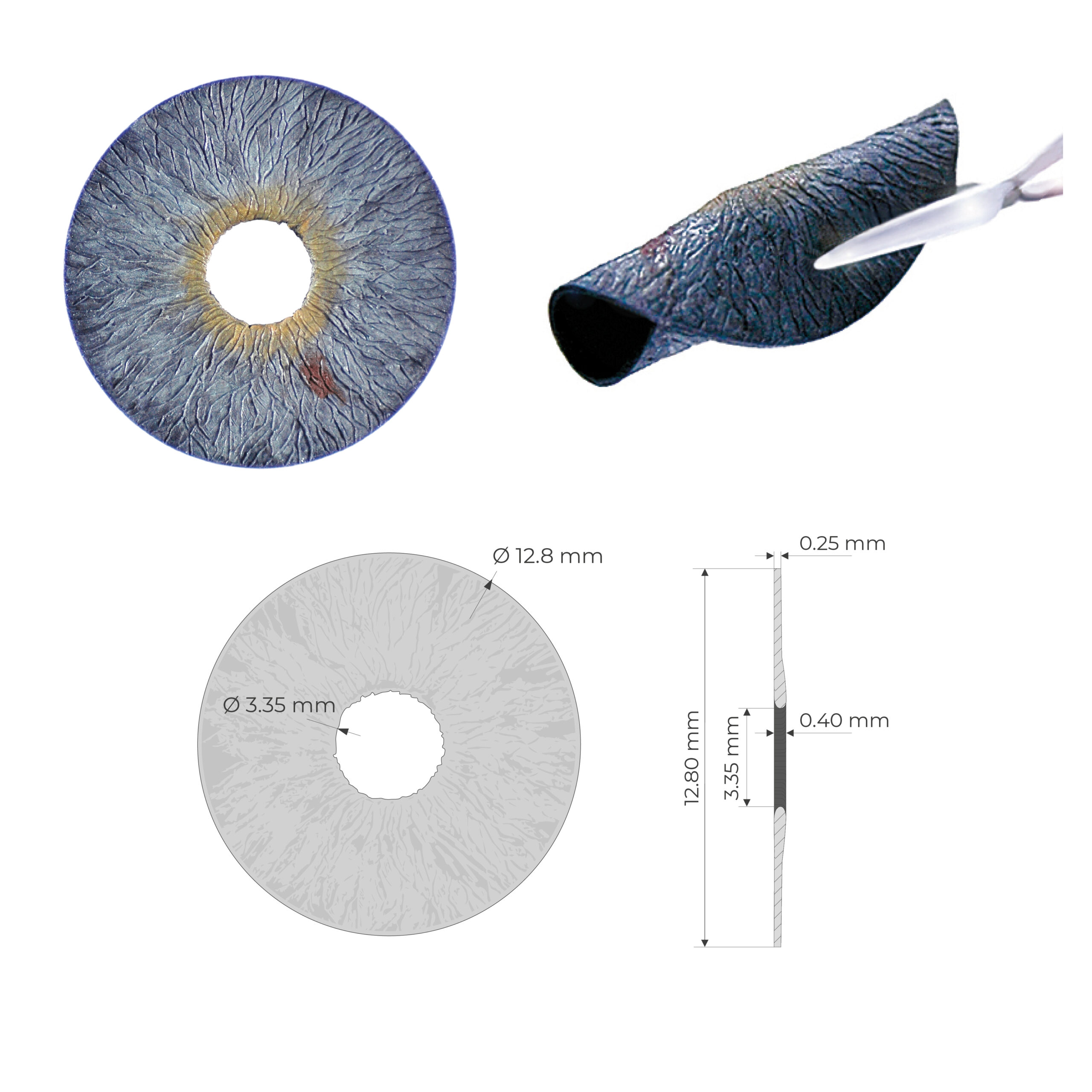 human-optics-artificial-iris