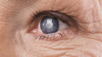 human-optics-menu-grauer-star